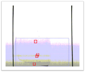 Water Condensation droplets on IV bag shell
